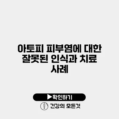 아토피 피부염에 대한 잘못된 인식과 치료 사례